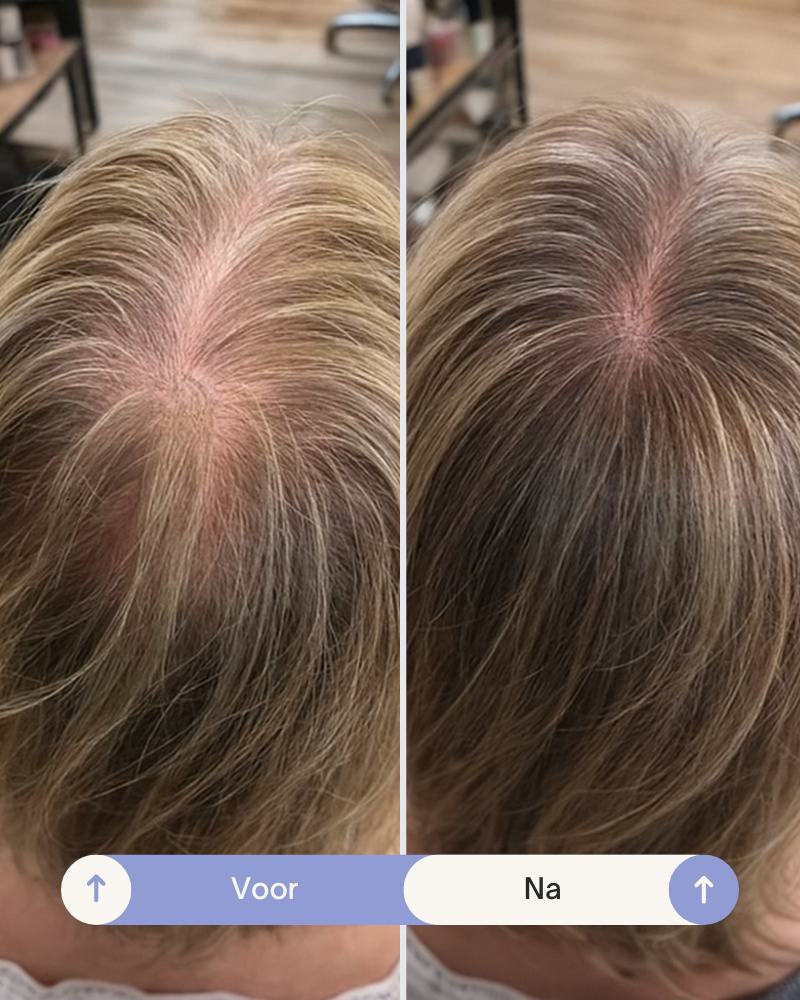 Grow Perfect™ Shampoo - Image 5